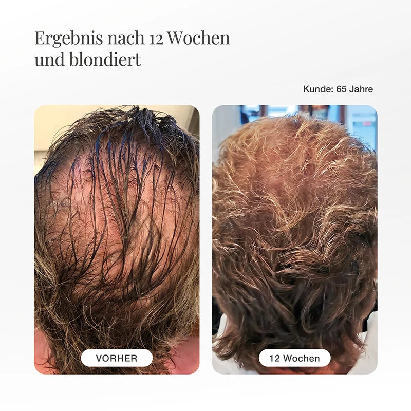Haarserum für Männer